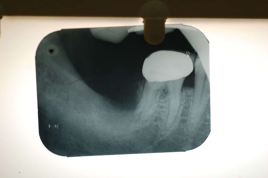%_tempFileNameImplant%202b1%