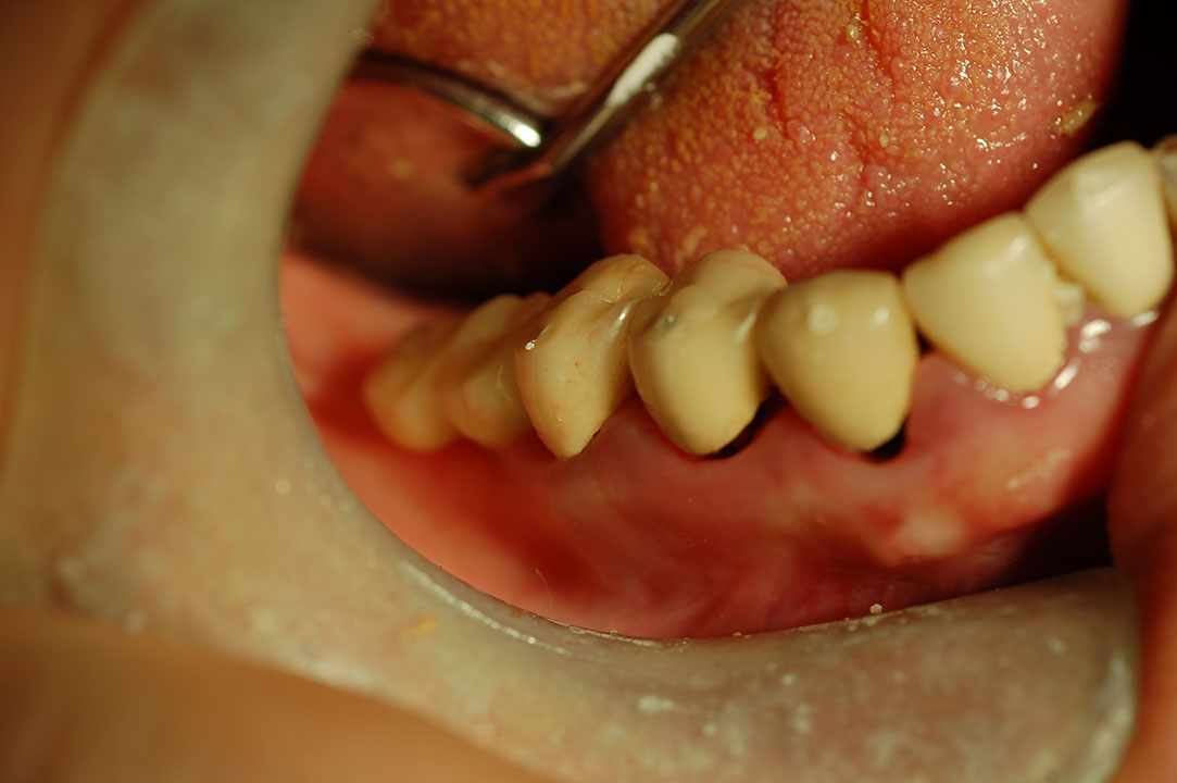 %_tempFileNameImplant%2031a%