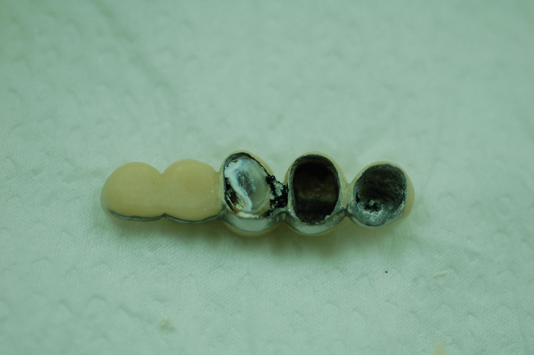 %_tempFileNameImplant%2031e%