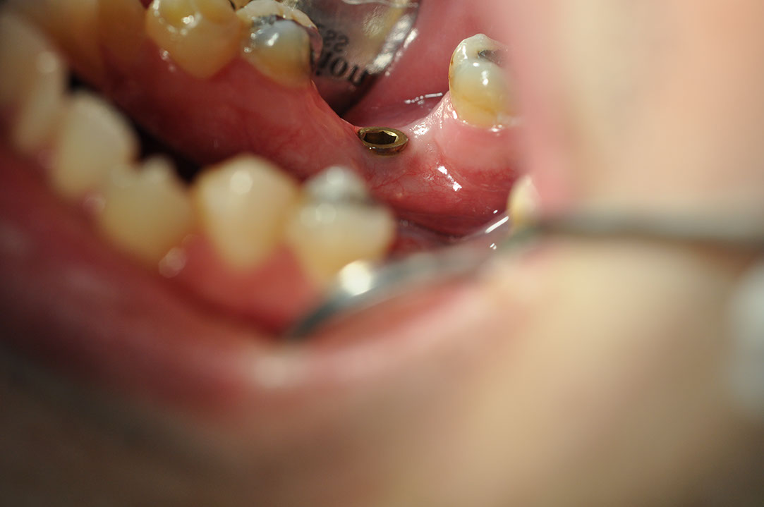 %_tempFileNameImplant%2032La4%