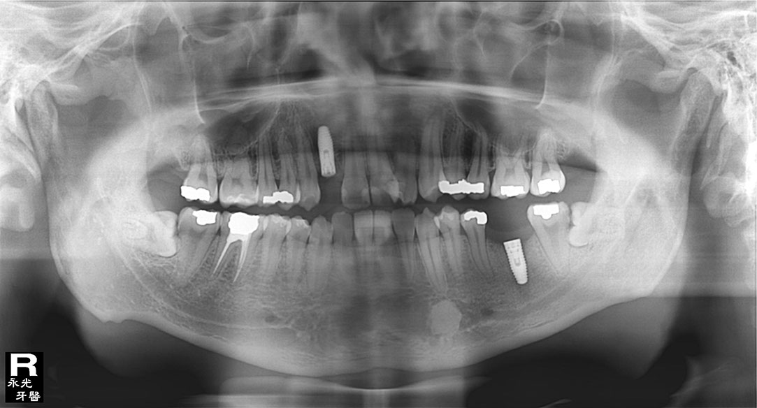 %_tempFileNameImplant%2032Lc2%