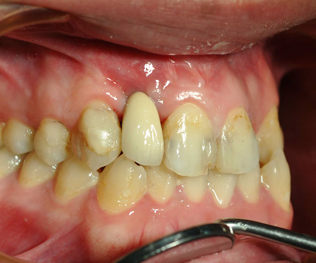 %_tempFileNameImplant%2032e4%