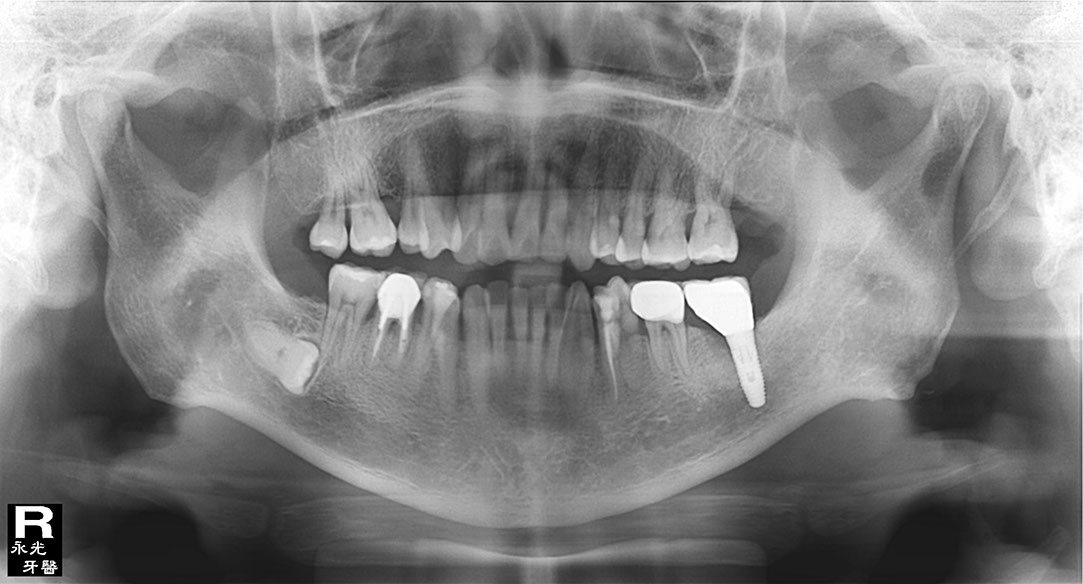 %_tempFileNameImplant%2034h4%