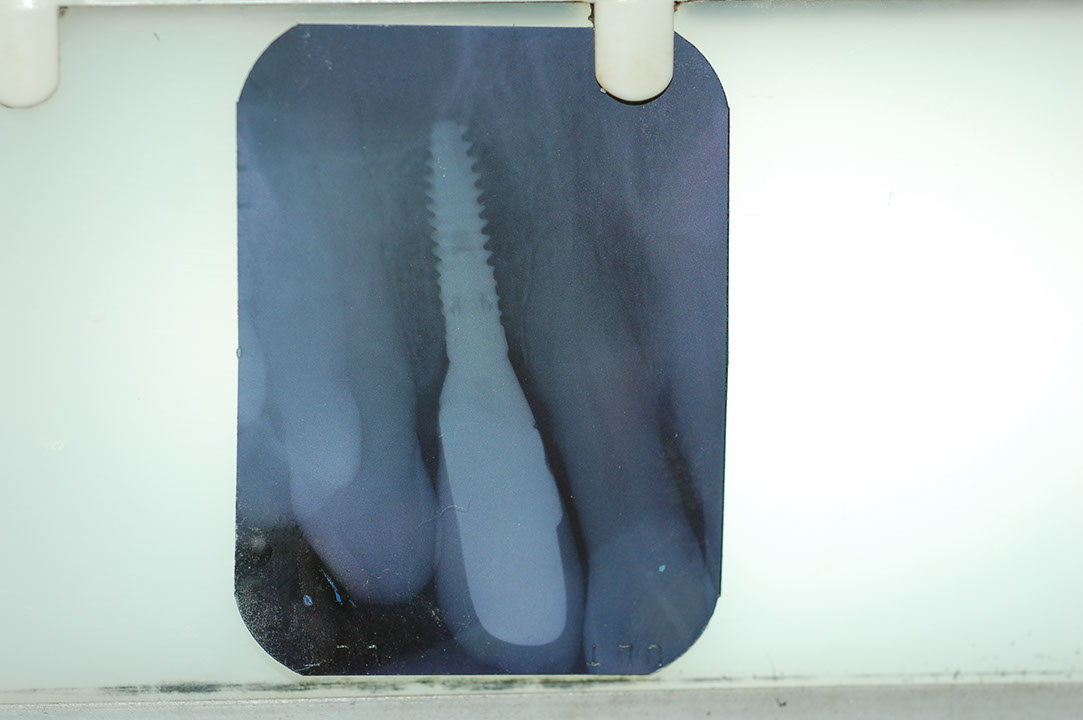 %_tempFileNameImplant%203c5%