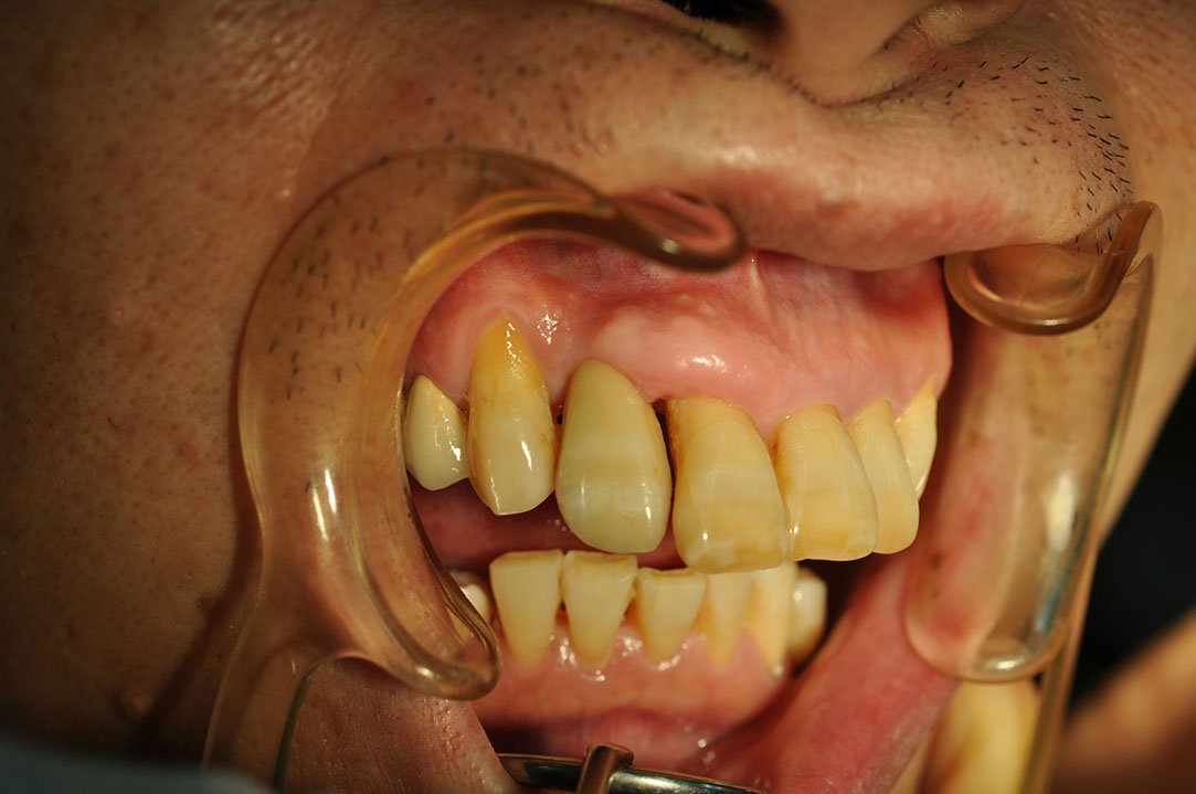 %_tempFileNameImplant%203m4%
