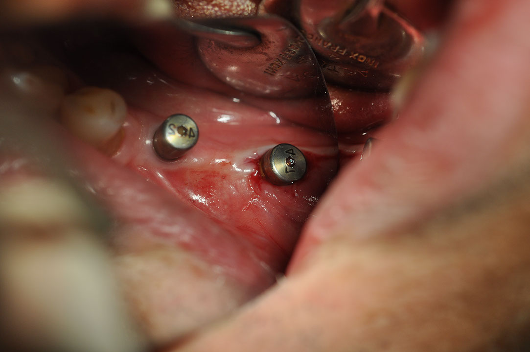 %_tempFileNameImplant%2040c4%