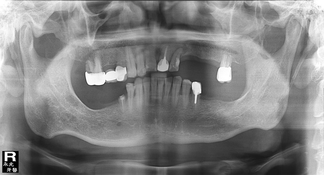 %_tempFileNameImplant%2040e1%