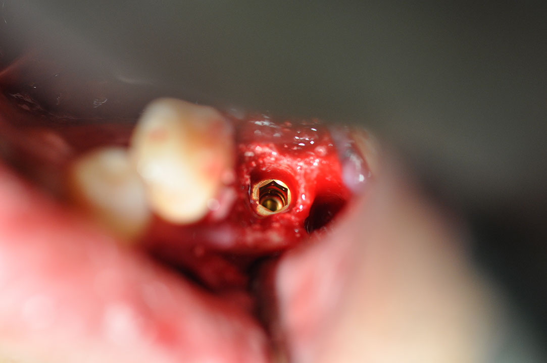 %_tempFileNameImplant%2044c%