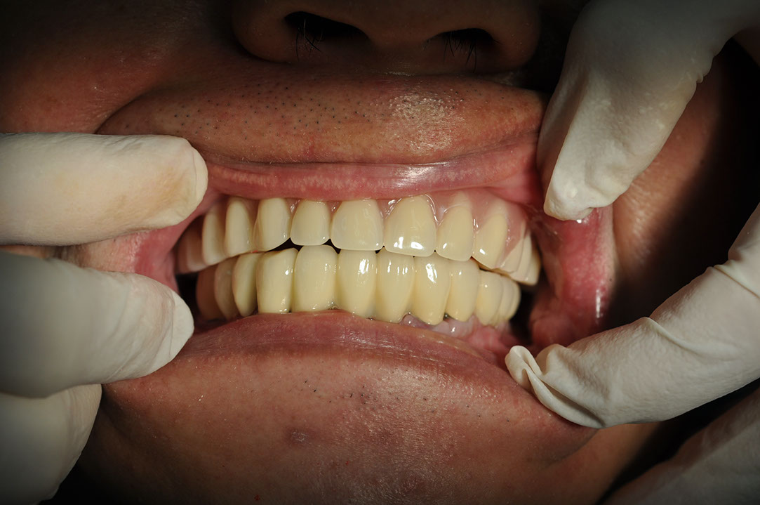 %_tempFileNameImplant%2045c1%