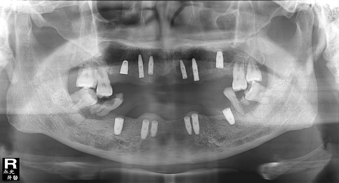 %_tempFileNameImplant%2045d2%