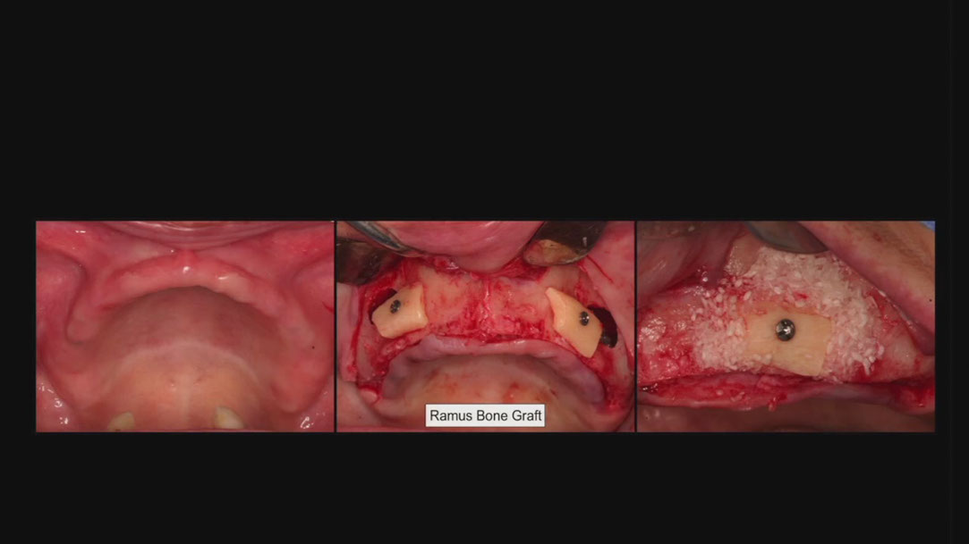 %_tempFileNameImplant%2053h1%