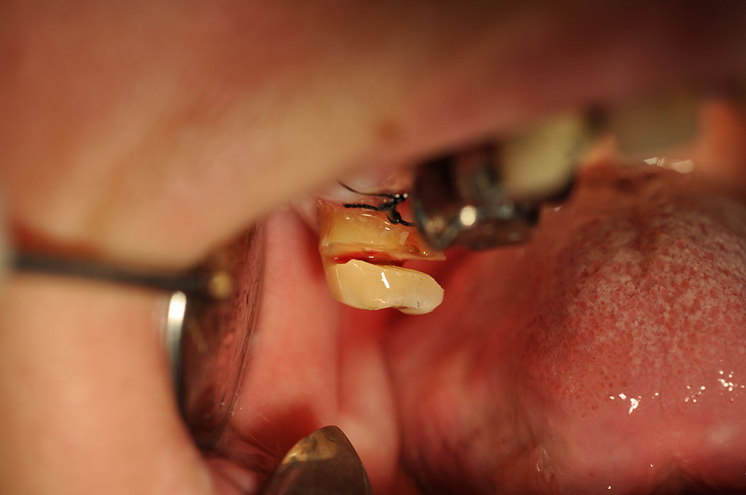 %_tempFileNameImplant%2055b2%