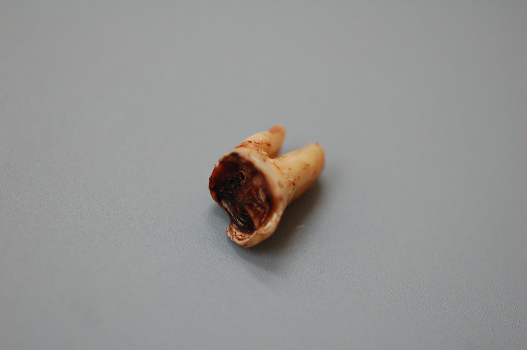 %_tempFileNameImplant%205f1%