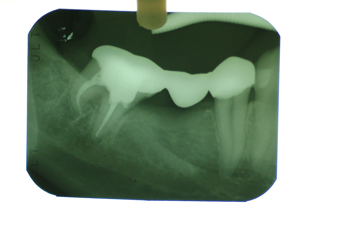 %_tempFileNameImplant%205q3%