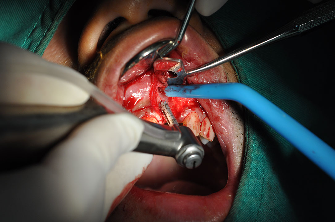%_tempFileNameImplant%2061b3%