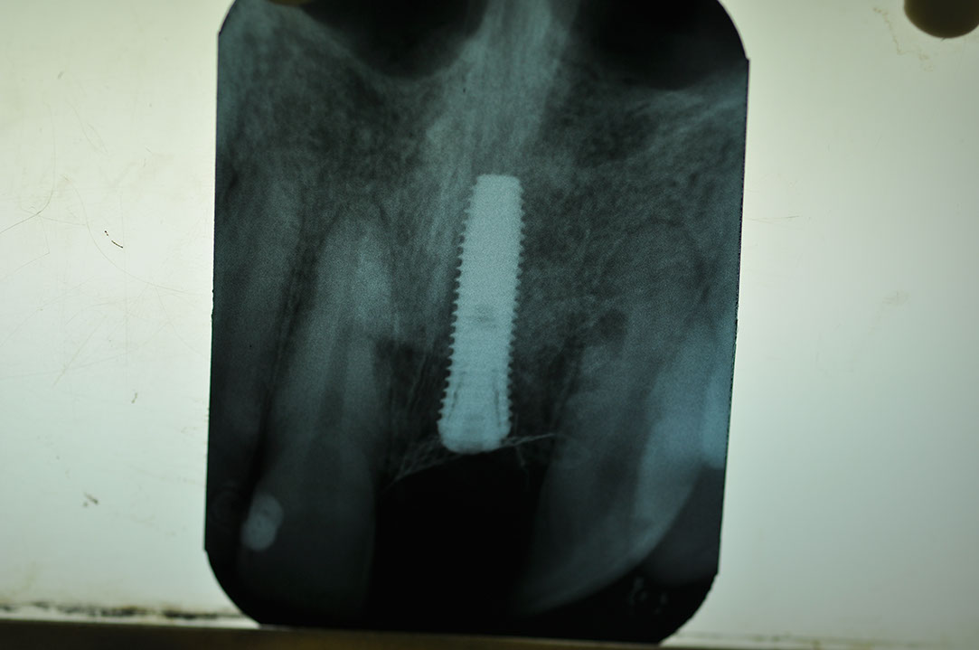 %_tempFileNameImplant%2061b8%