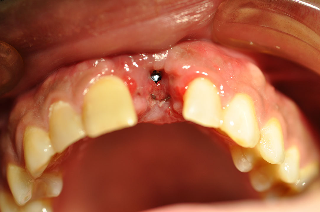 %_tempFileNameImplant%2061b9%