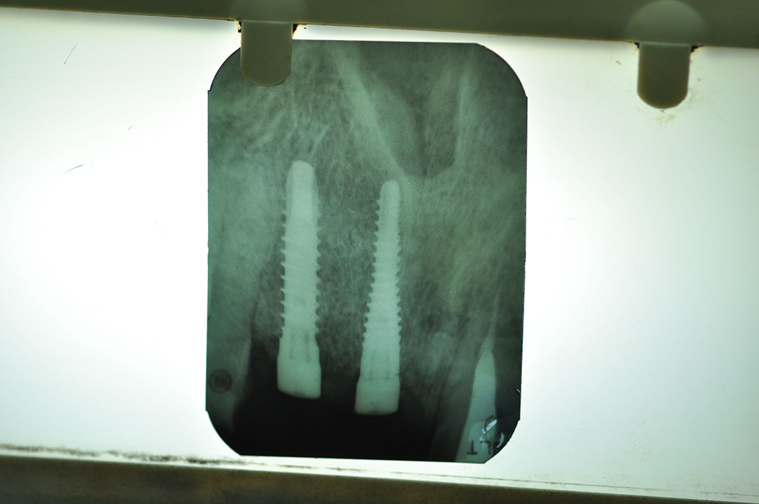 %_tempFileNameImplant%2066d2%