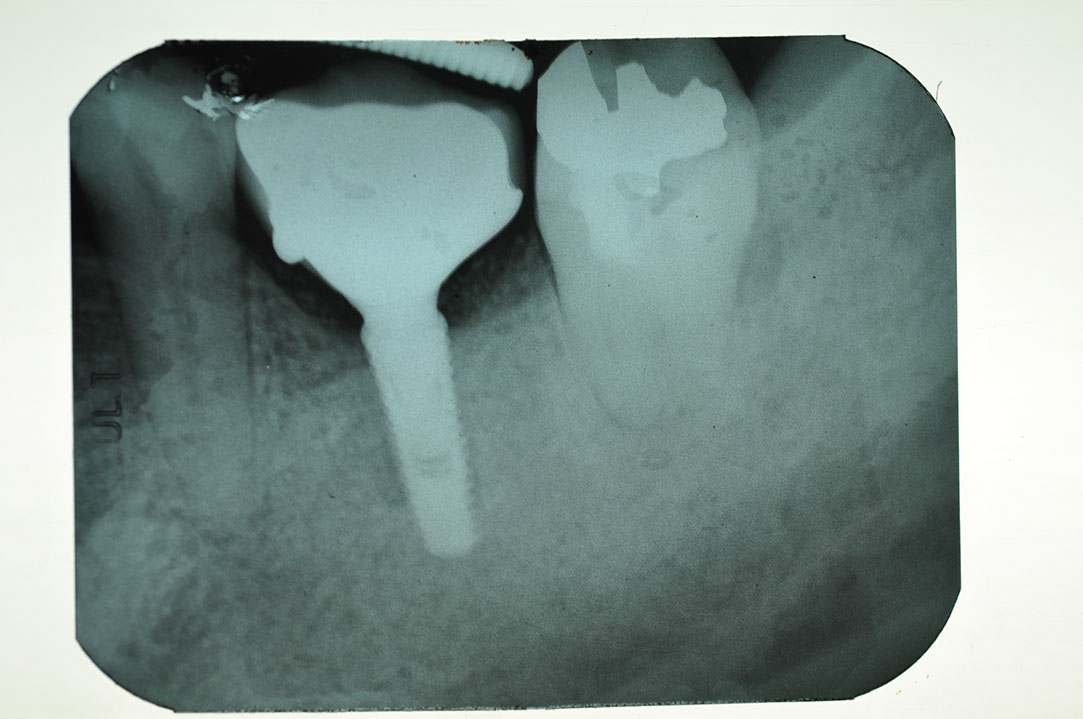 %_tempFileNameImplant%2075c3%