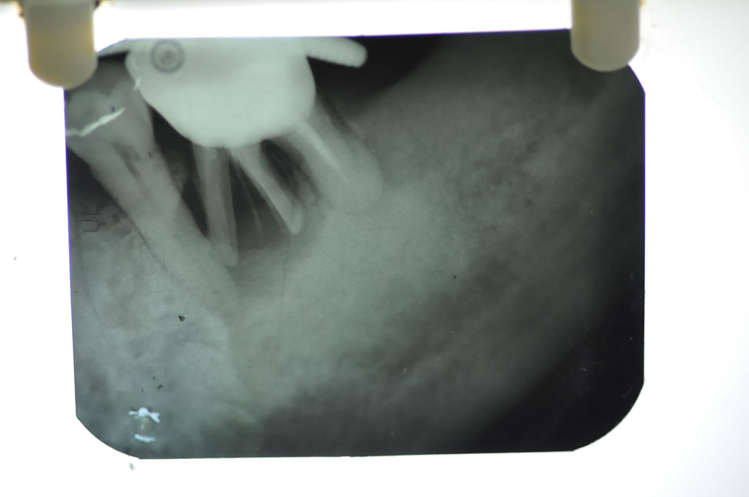 %_tempFileNameImplant%2079a1%