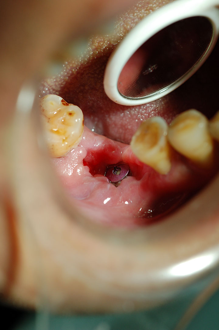 %_tempFileNameImplant%207a3%