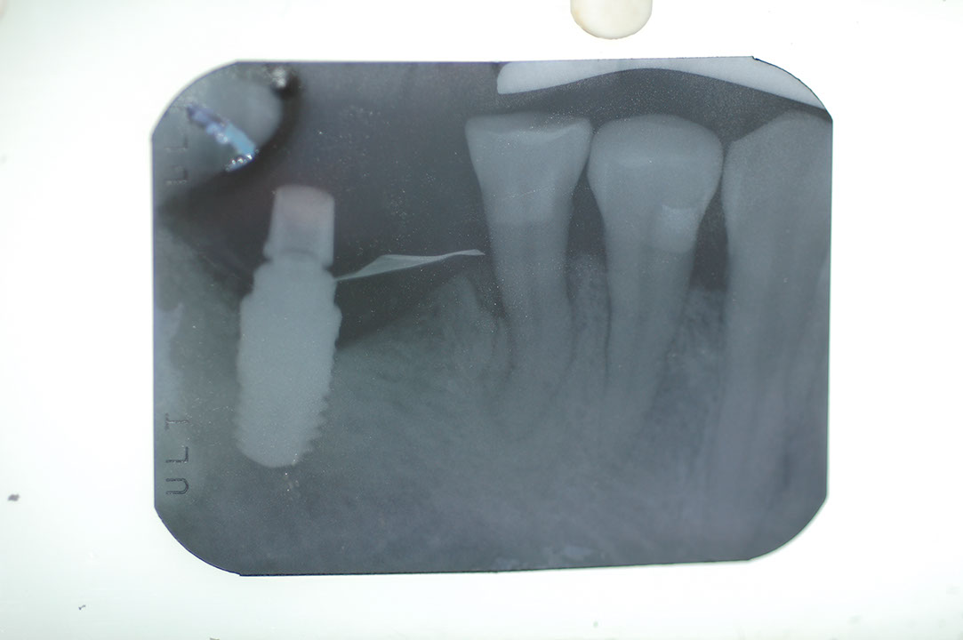 %_tempFileNameImplant%207b3%