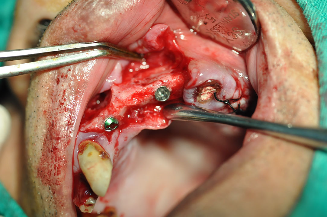 %_tempFileNameImplant%2080b4%