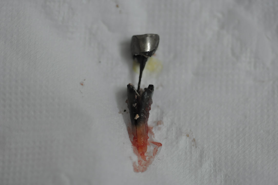 %_tempFileNameImplant%2085a3%
