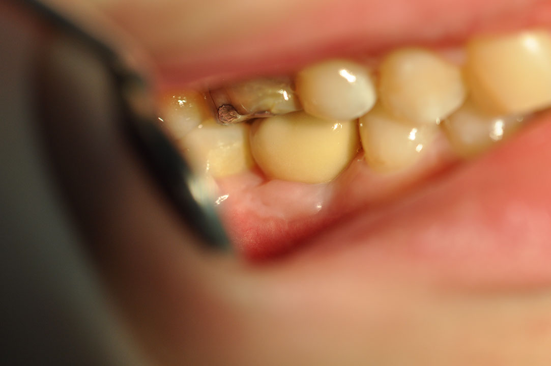 %_tempFileNameImplant%2086c5%
