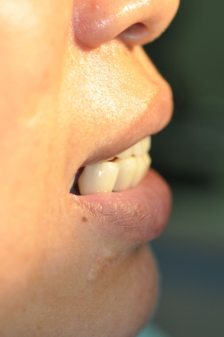 %_tempFileNameImplant%2089a6%