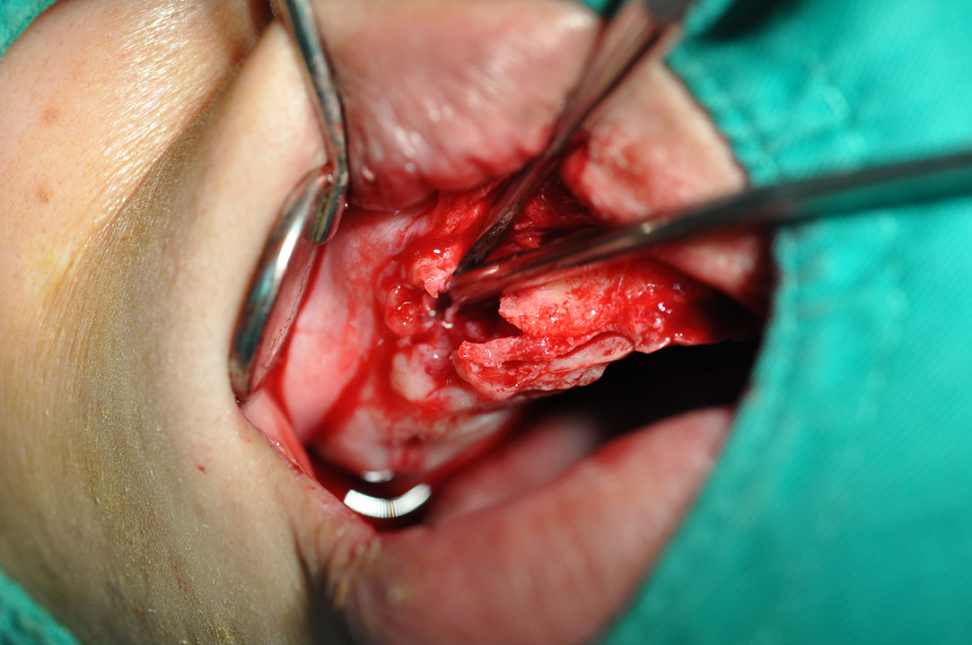 %_tempFileNameImplant%2089b2%