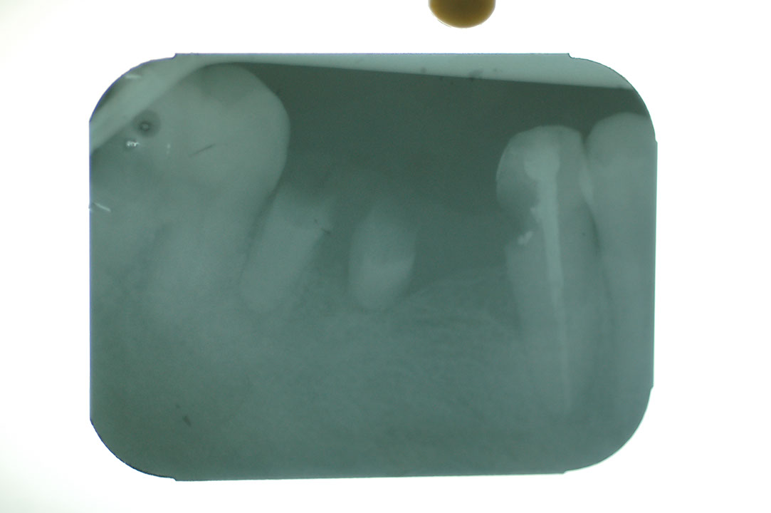 %_tempFileNameImplant%208g%