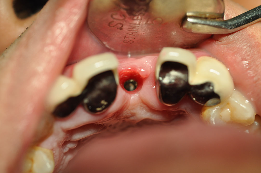 %_tempFileNameImplant%2090c7%
