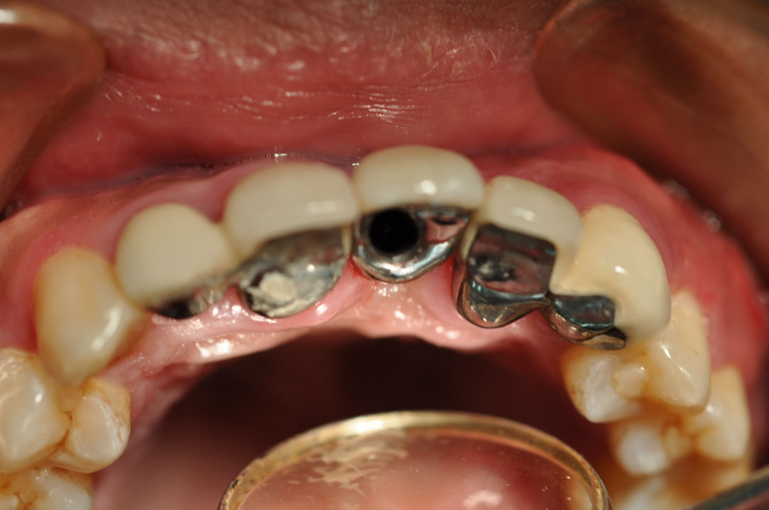%_tempFileNameImplant%2090d2%