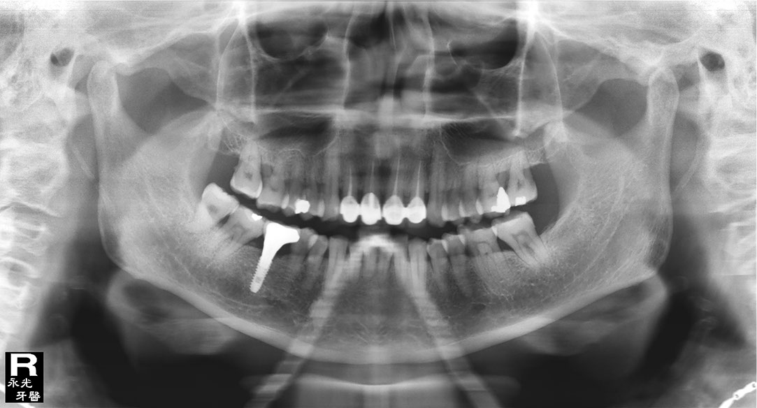 %_tempFileNameImplant%2091c2%