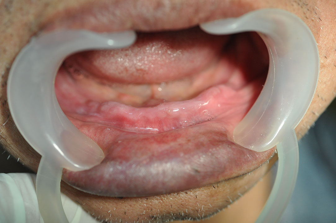 %_tempFileNameImplant%2092a1%