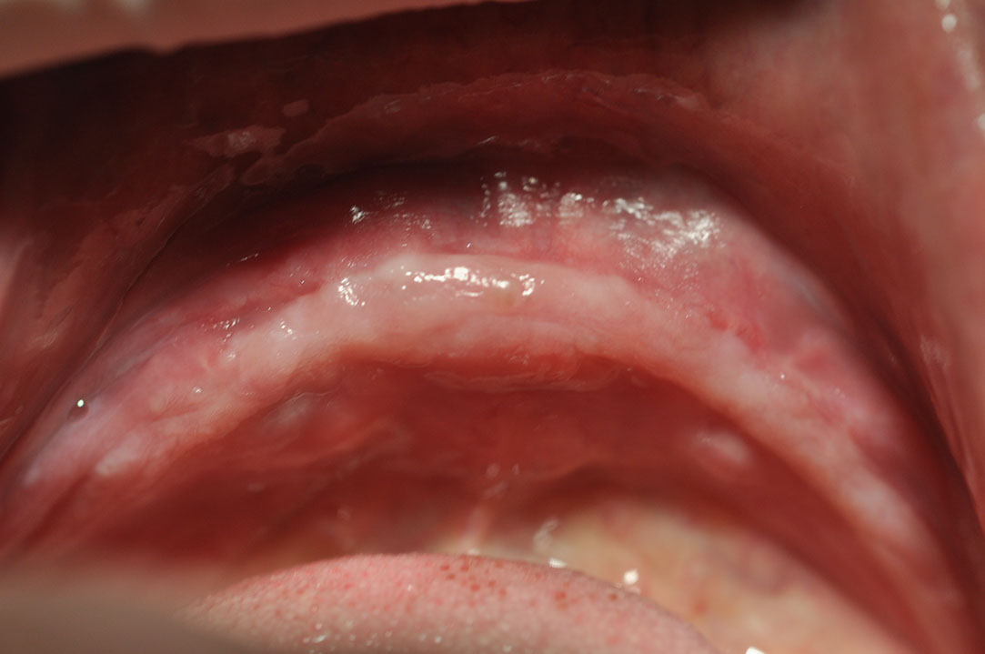 %_tempFileNameImplant%2092b1%