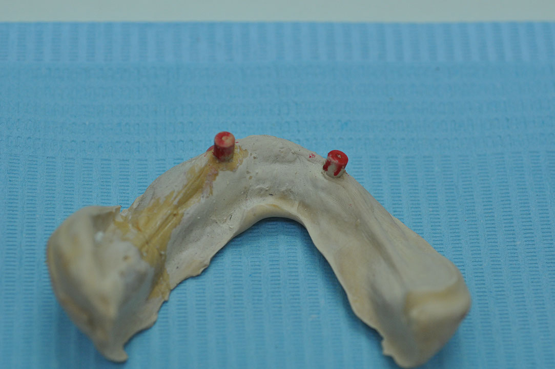 %_tempFileNameImplant%2092b4%