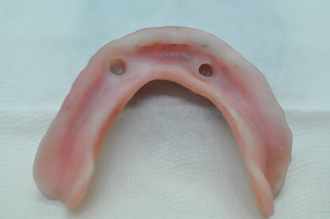 %_tempFileNameImplant%2092b5%