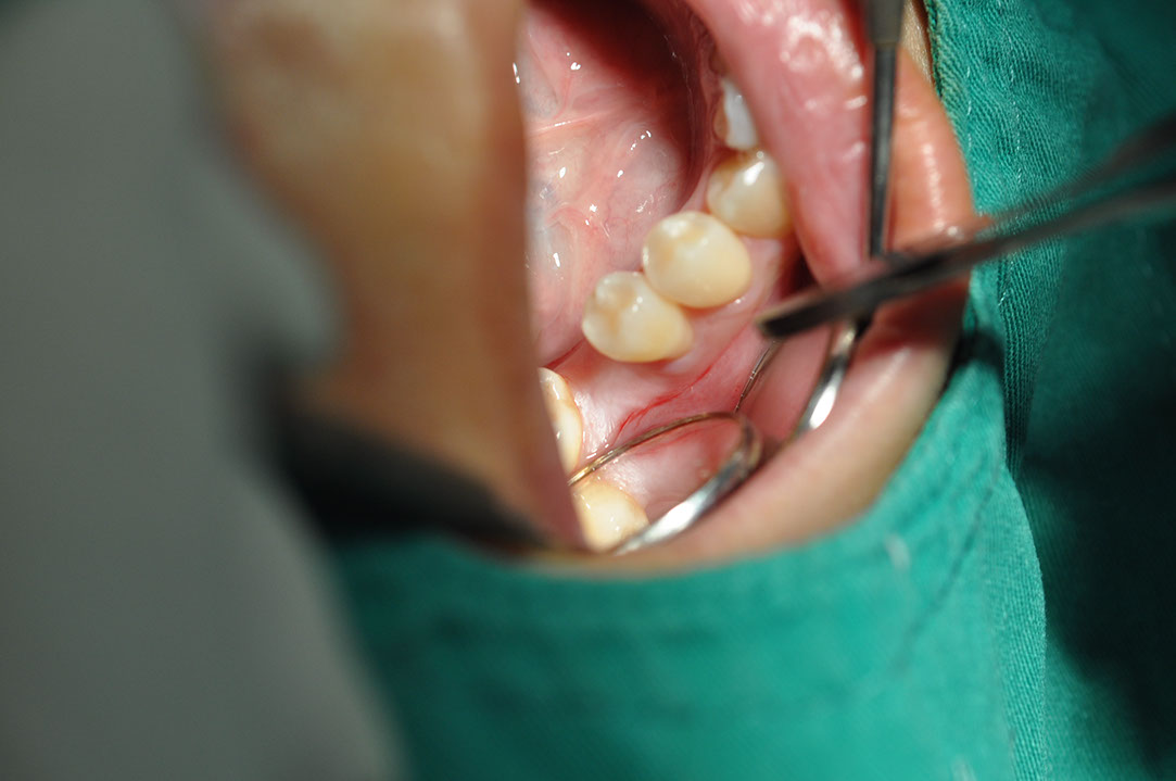 %_tempFileNameImplant%2093a1%