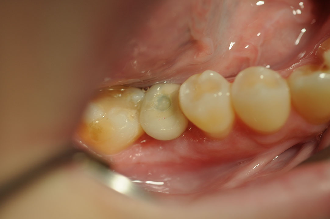 %_tempFileNameImplant%2093d2%