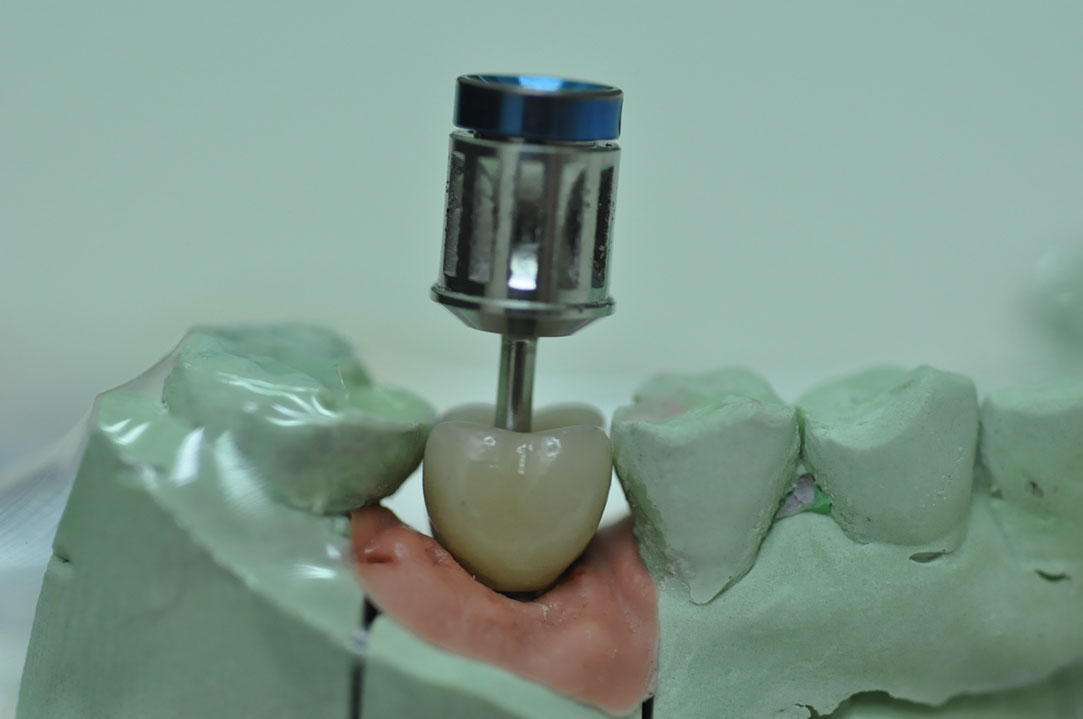%_tempFileNameImplant%2094b3%