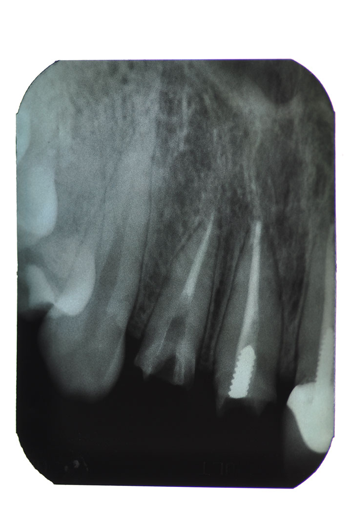%_tempFileNameImplant%2095a4%