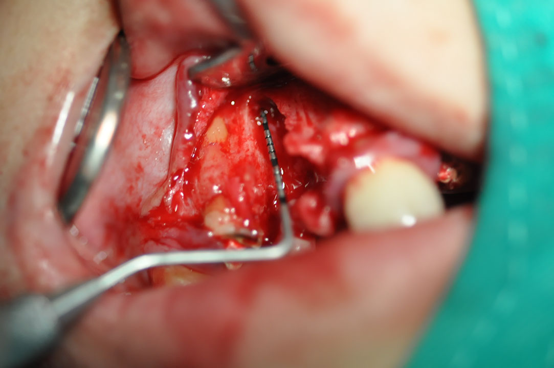 %_tempFileNameImplant%2095b5%