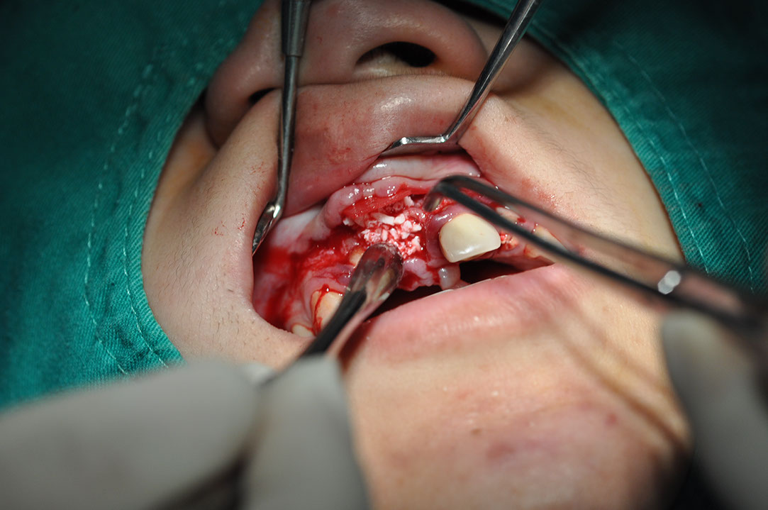 %_tempFileNameImplant%2095c3%