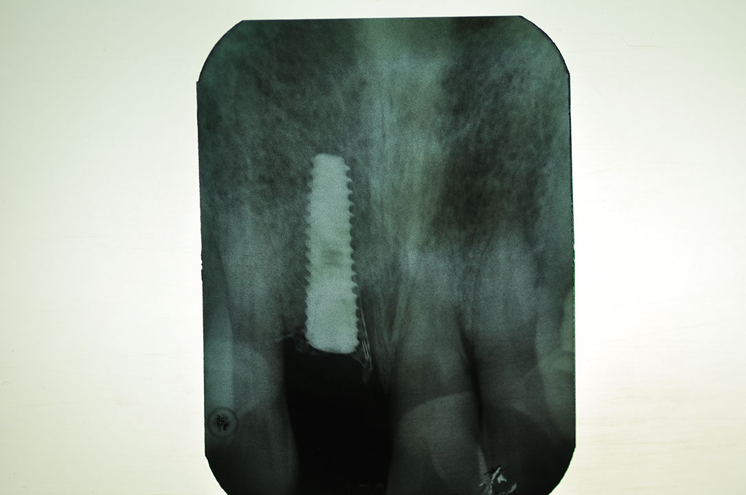 %_tempFileNameImplant%2096b3%