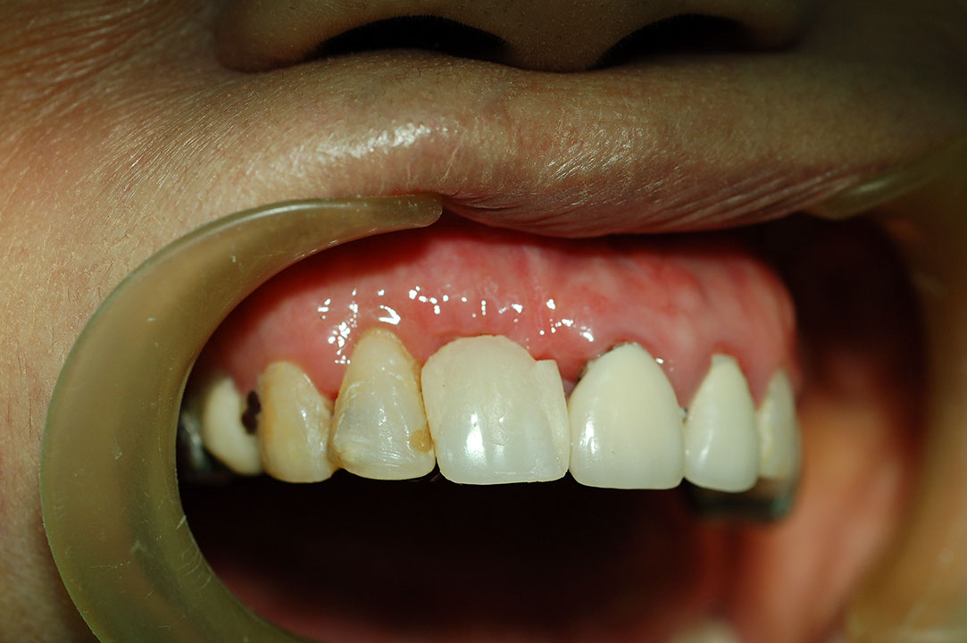 %_tempFileNameImplant%209h1%