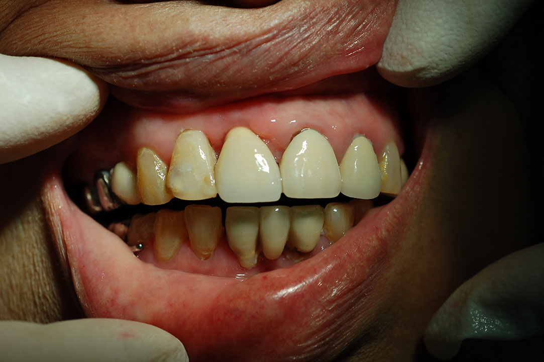 %_tempFileNameImplant%209j1%