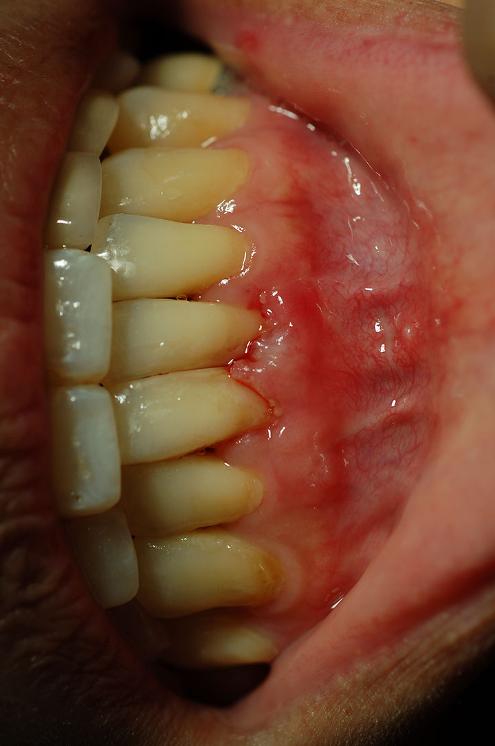 %_tempFileNamePerio%202o%