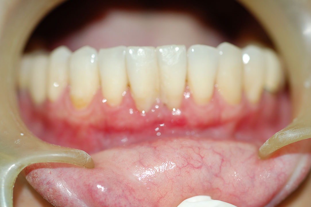 %_tempFileNamePerio%202r%